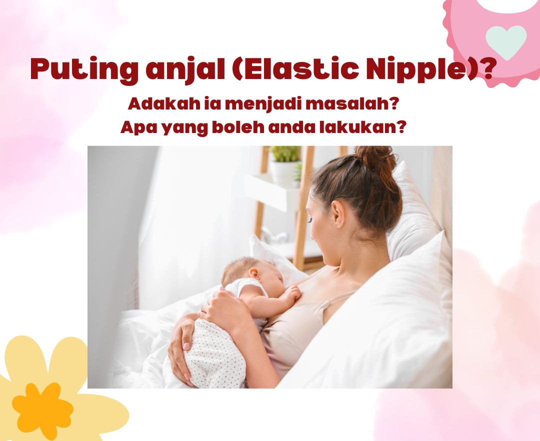 Puting Elastik: Apakah itu?
